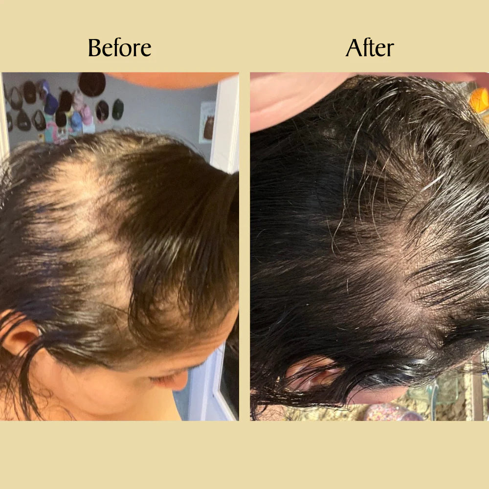 Bizalux™ Natural Hair Growth Oil