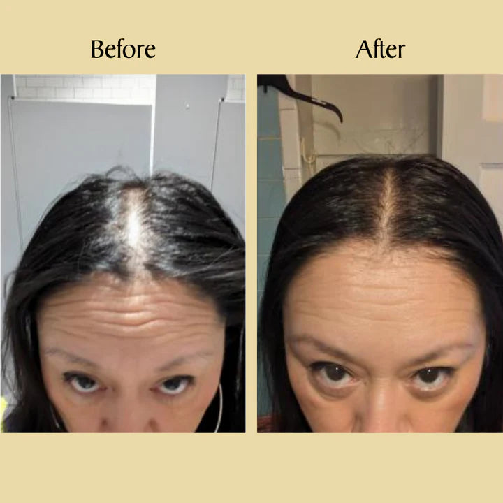 Bizalux™ Natural Hair Growth Oil