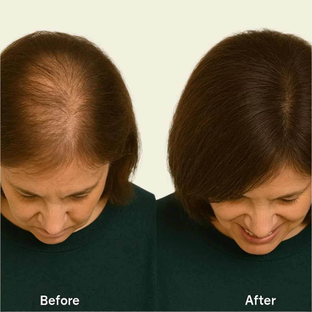Bizalux™ Natural Hair Growth Oil