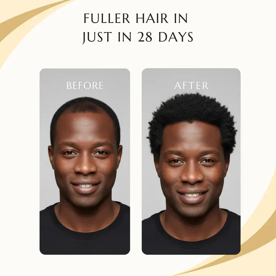 Bizalux Rosemary Roll-On Hair Growth Oil BIZALUX