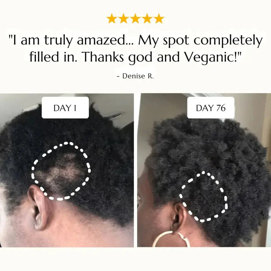 Bizalux Rosemary Roll-On Hair Growth Oil BIZALUX