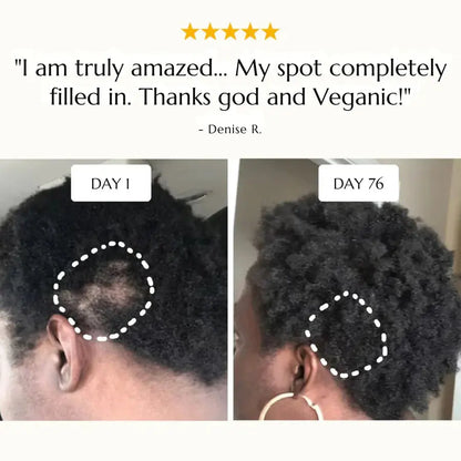 Bizalux Rosemary Roll-On Hair Growth Oil BIZALUX