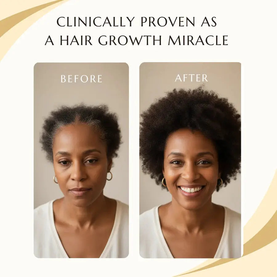 Bizalux Rosemary Roll-On Hair Growth Oil BIZALUX